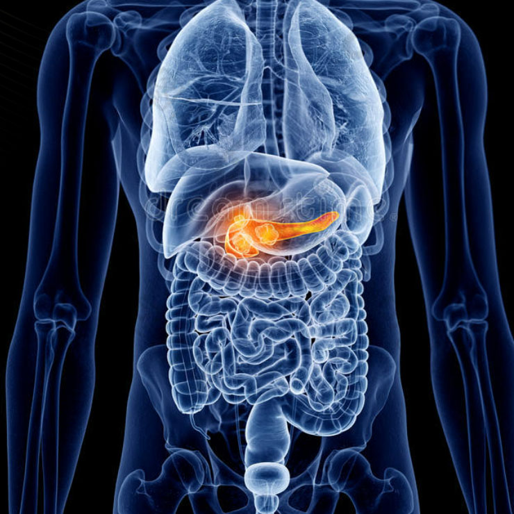 Pancreatic Cancer