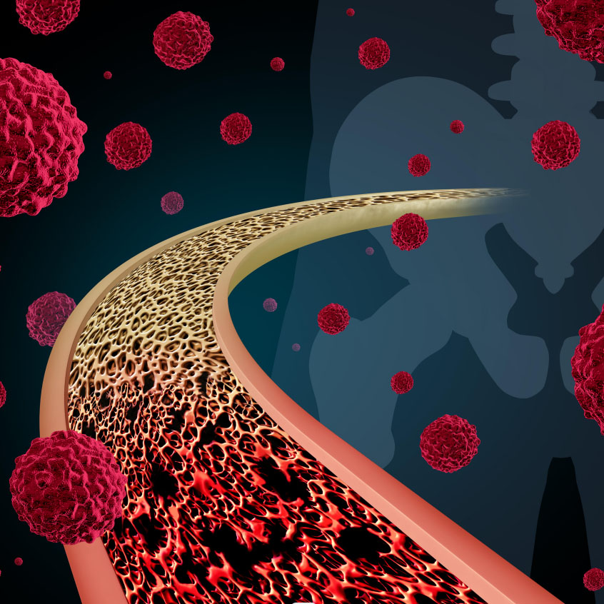 Understanding the Mechanism and Implications of Necroptosis: A Breakthrough in Cell Death Research