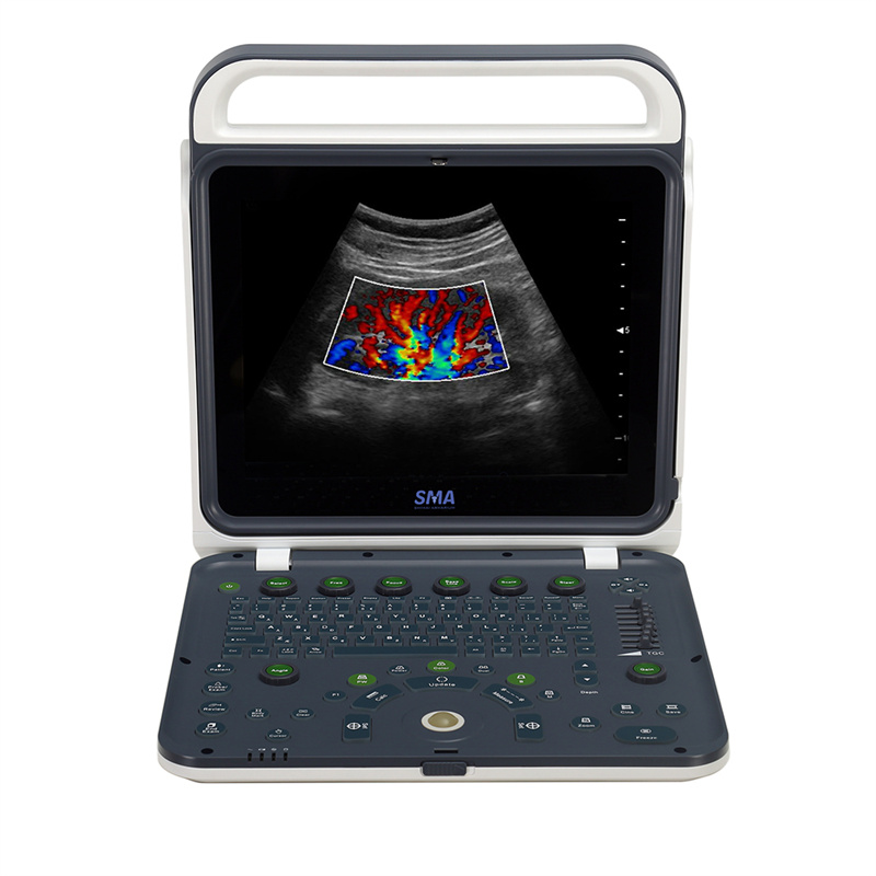 Discover the Benefits of a Portable Doppler Ultrasound for Medical Applications