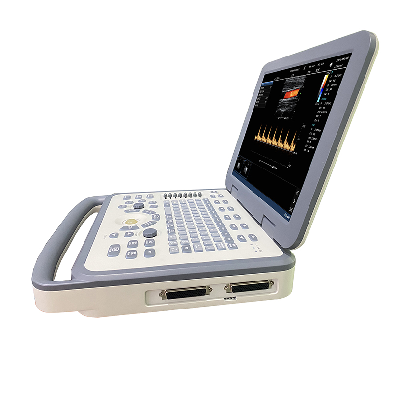 Portable ultrasound machine M61 color doppler diagnostic system for ultrasonic notebook scanner