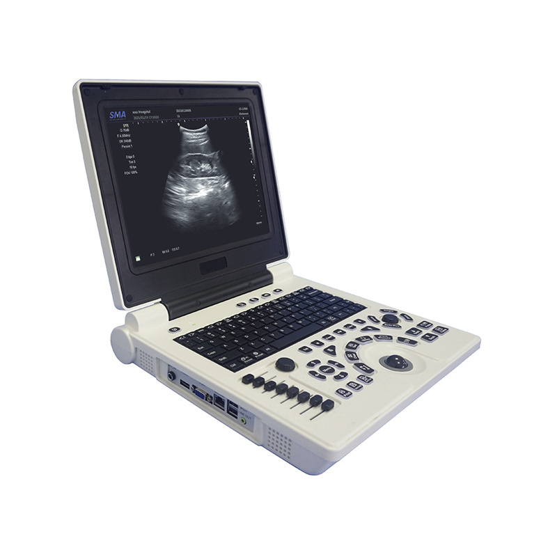 Highly advanced ECG machine with enhanced features and quality performance