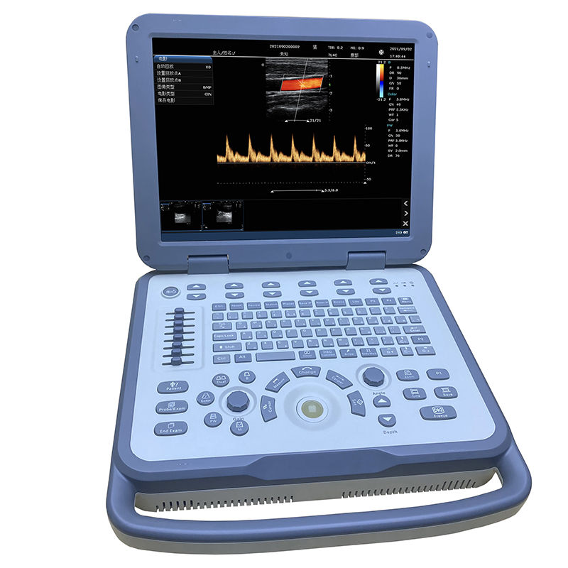 Advanced Multiparameter Patient Monitor for Comprehensive Health Monitoring