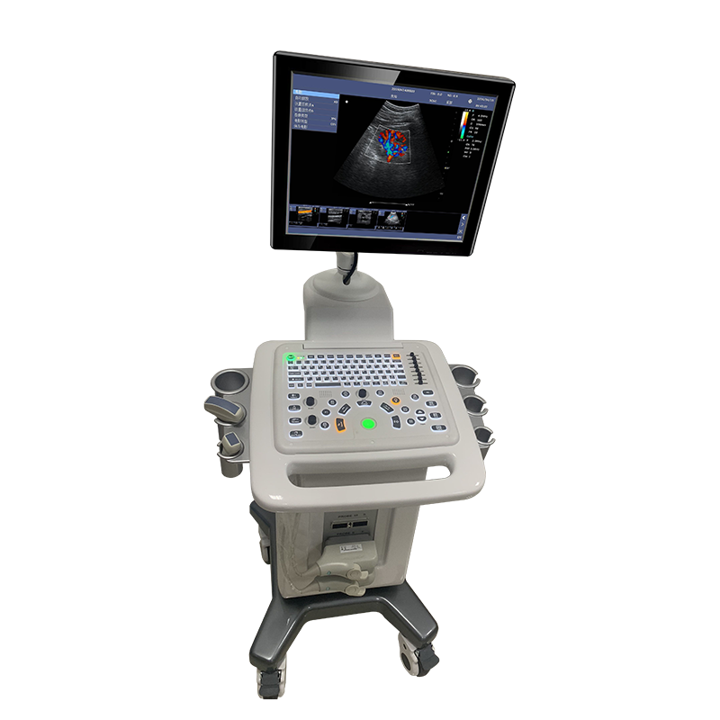 Doppler ultrasound diagnosis system LCD high resolution medical trolley ultrasound machine