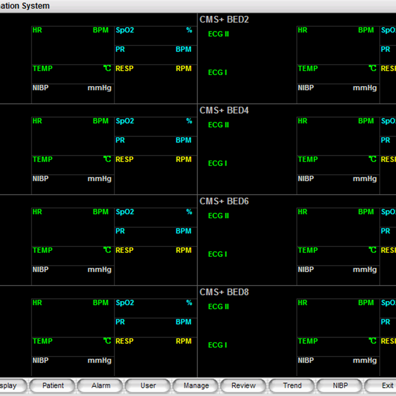 Central monitoring system SM-CMS1 continuous monitoring