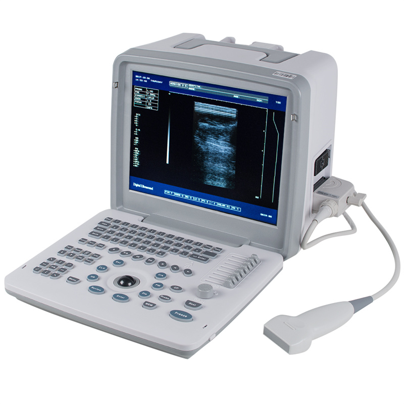 Portable 3D Medical Ultrasound Machines: A Breakthrough in Diagnostic Imaging