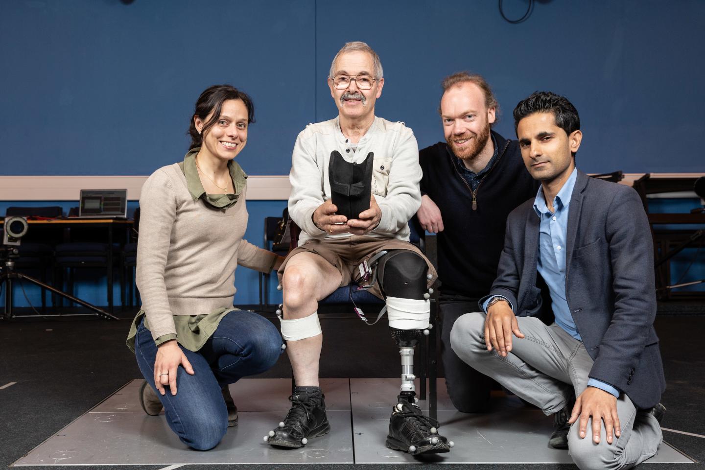 How long do prosthetic liners last?