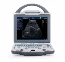 KX-5600 B Mode Ultrasound Machine Convenient to Work Portable/ Laptop/ Medical Ultrasound Equipment