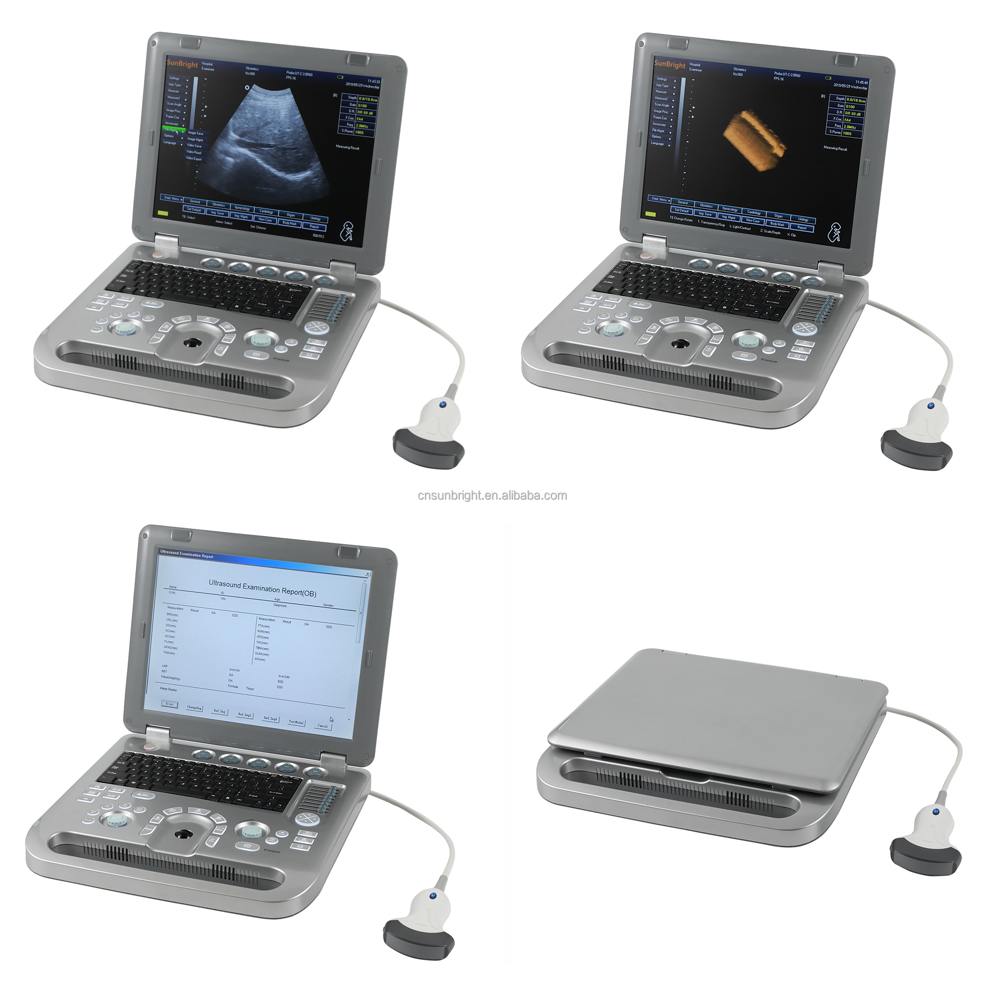Factory Supply GDM-013 800D Medical Ultrasound Imaging Scanner