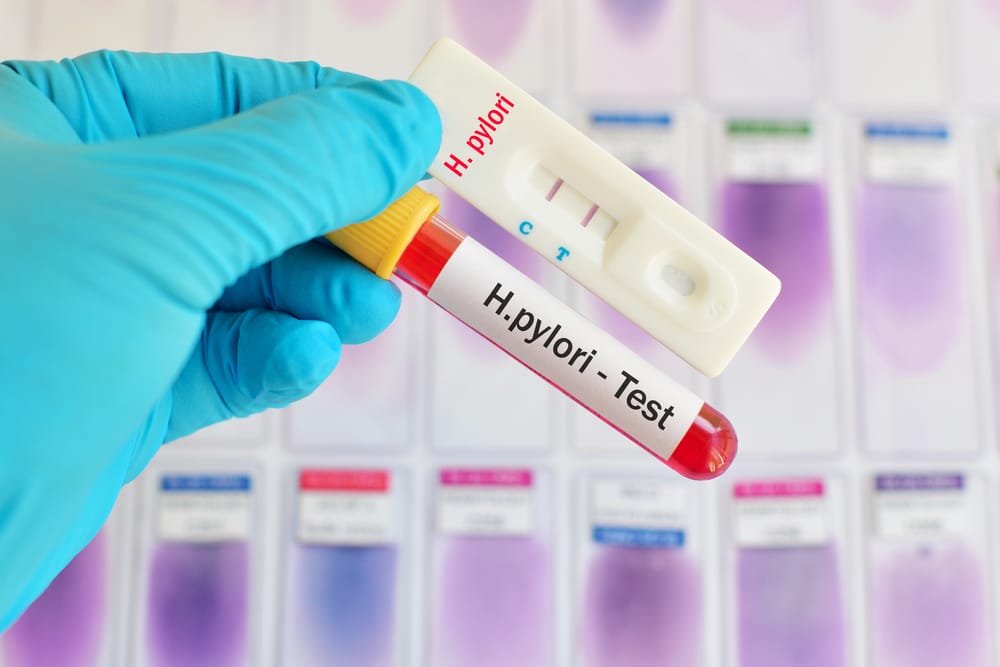 Helicobacter pylori - Symptoms, Causes, Treatments | Healthgrades.com