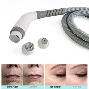 RF wrinkle removal, face lifting, lifting