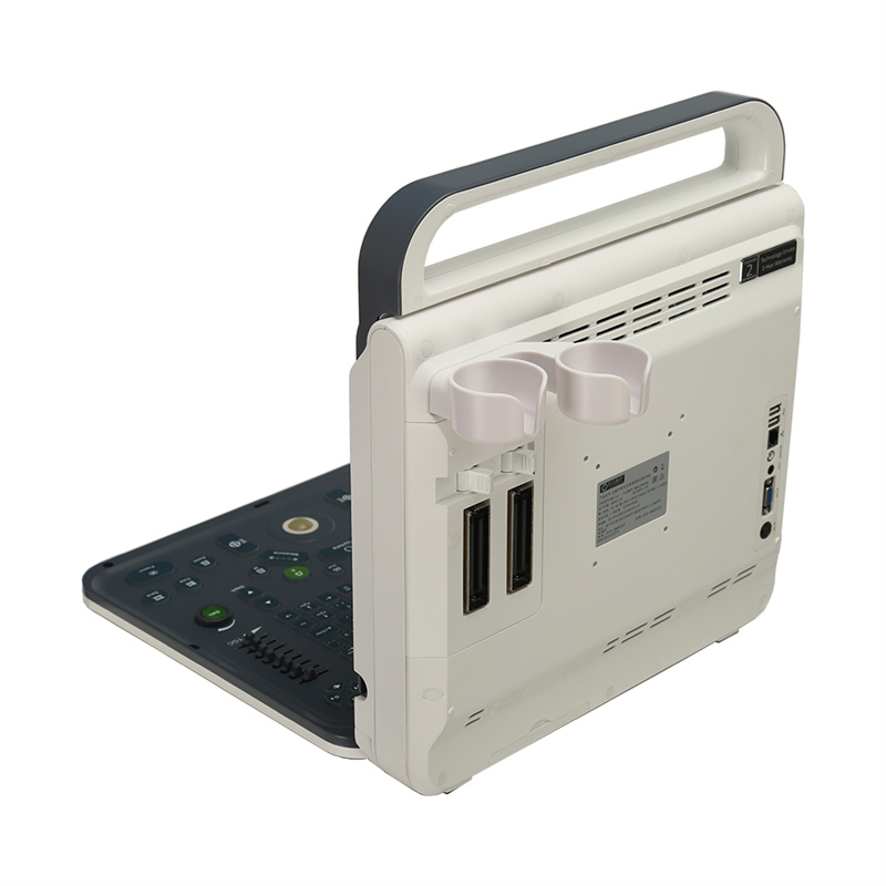 Portable ultrasonic M60 scanner medical standard medical equipment with workstation