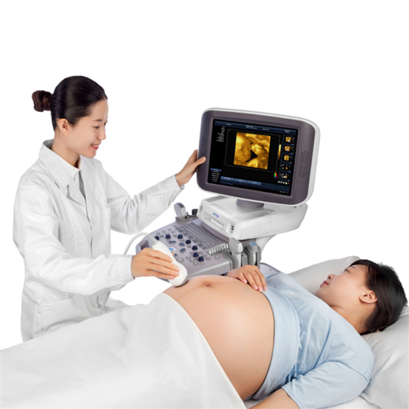 SM S60 Ultrasonic scanner 3D 4D color doppler trolley Sonography diagnosis system 