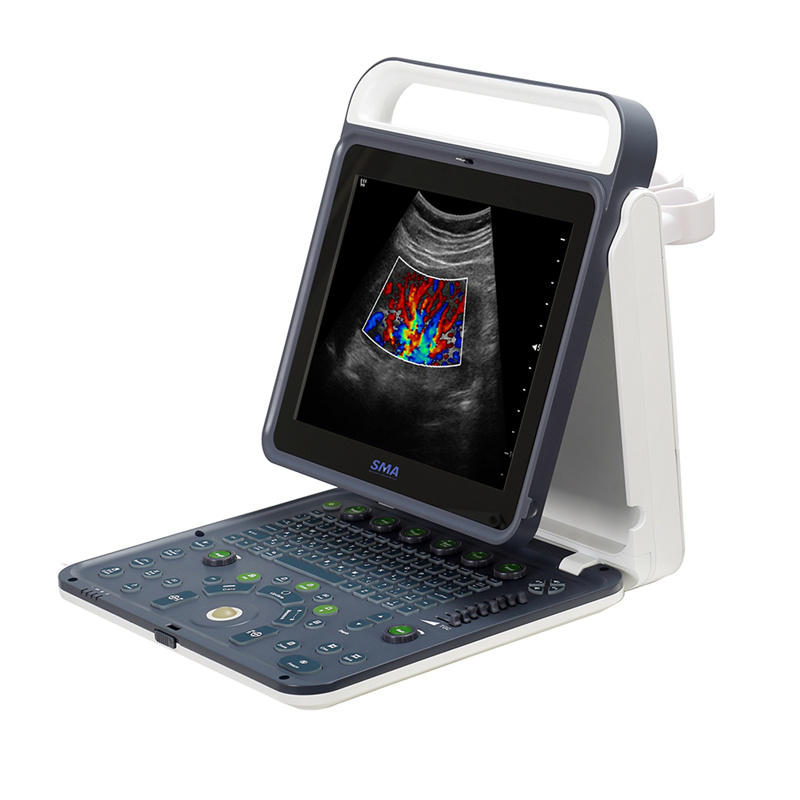 Portable ultrasonic M60 scanner medical standard medical equipment with workstation