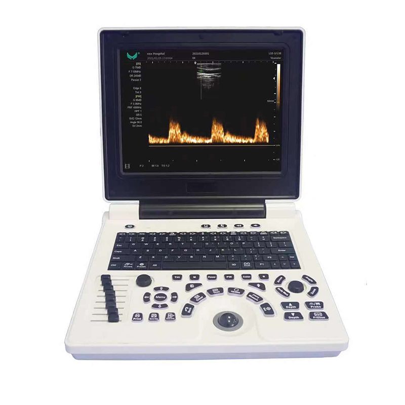 Ultrasound instruments 2D 3D 4D doppler echo portable Laptop digital 12inch color portable Machine medical 