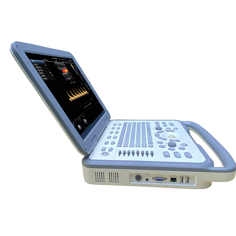 Portable ultrasound machine M61 color doppler diagnostic system for ultrasonic notebook scanner