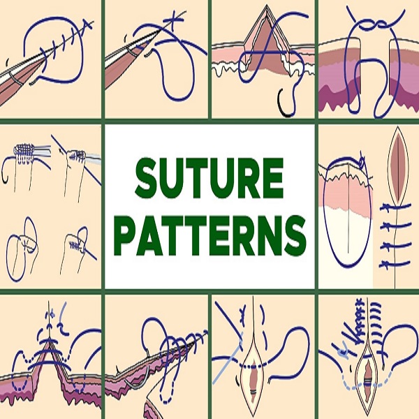 Common Suture Patterns（2）