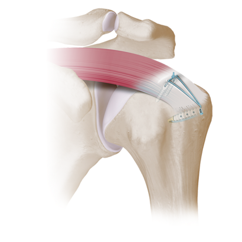 Effective Treatment for Facial Wounds with Plaster