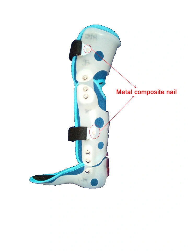 Metal Composite Nails for Health and Medical Prostheses
